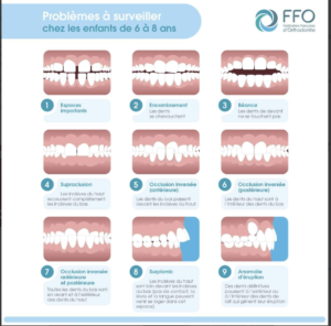 Orthodontie Enfant Villeurbanne Orthodontiste Villeurbanne Lyon